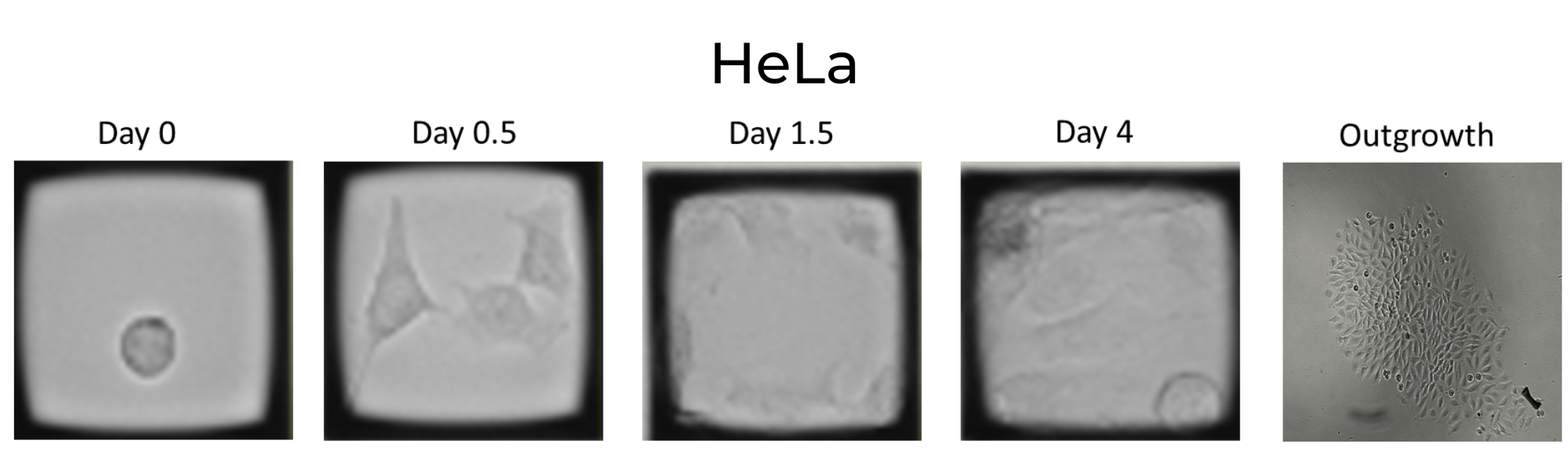 HeLa e1674508095108