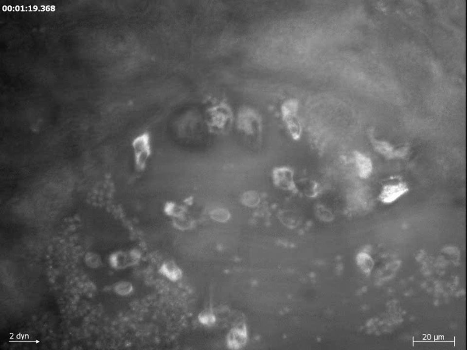 BioFlux System Blood Endothelial Cell Interaction Using RICM 1