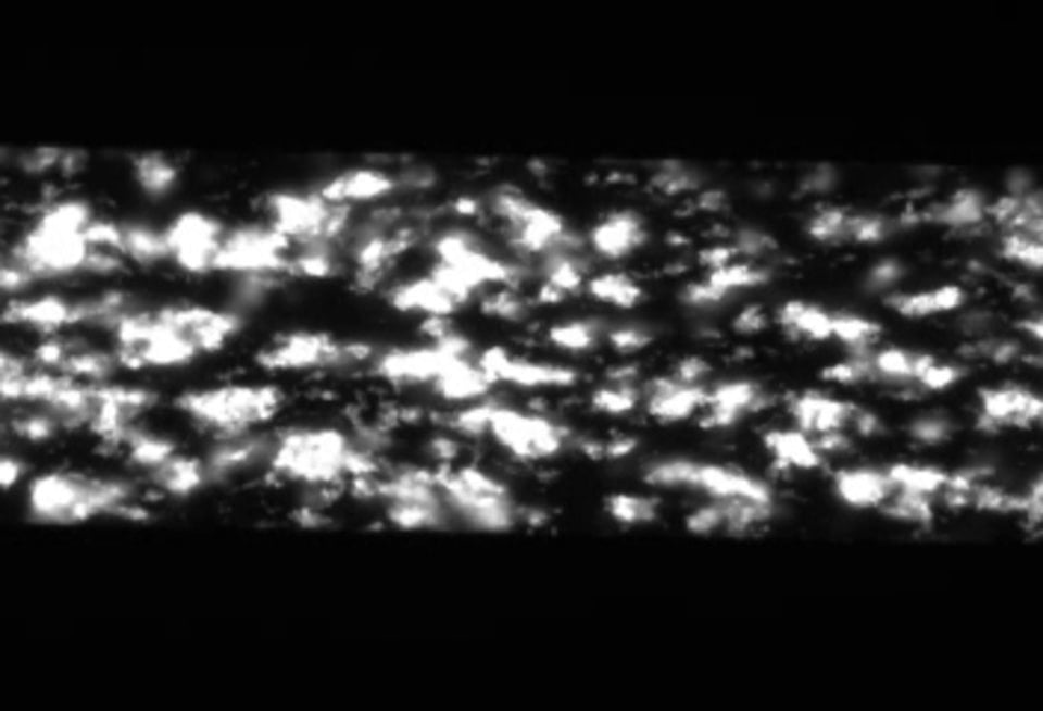 BioFlux System CalceinAM Labeled Platelet Aggregation on Collagen 1 1