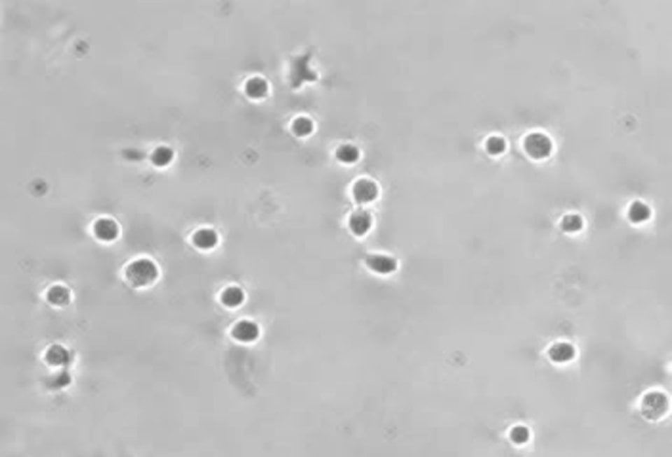 BioFlux System HL60 Cells Rolling on E Selectin 1