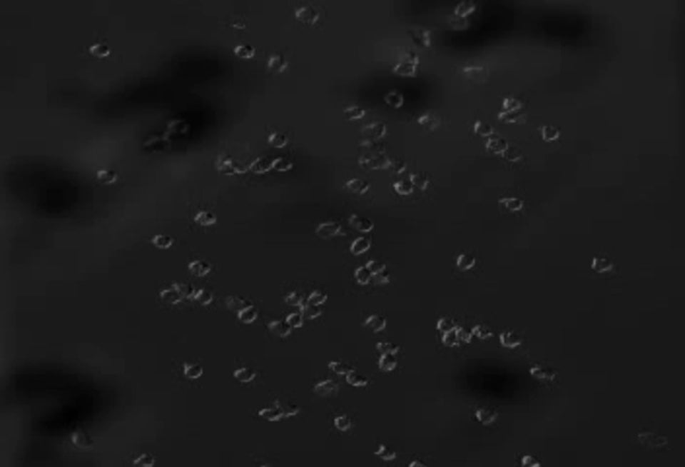 BioFlux System Human Neurtophil Migration fMLP Imaged Using DIC 1