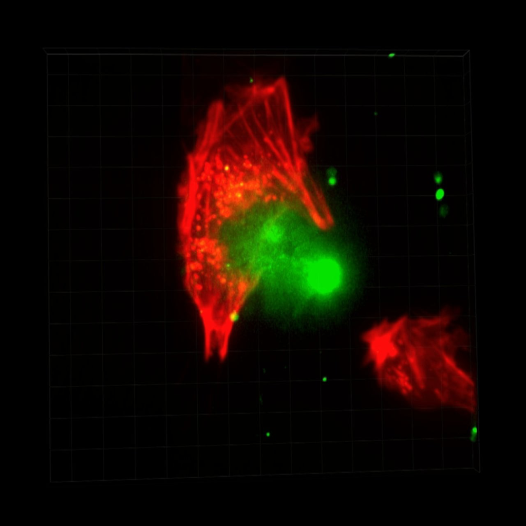 BioFlux System PC3 Cells Invade Lymphatic Endothelial Cells in 3D 1