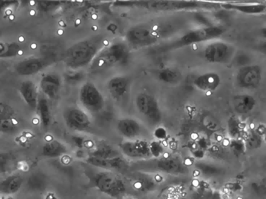 BioFlux System Transmigration 1
