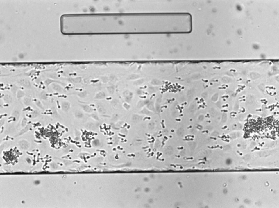 BioFlux System Yeast Adhering to HUVEC Monolayer 1