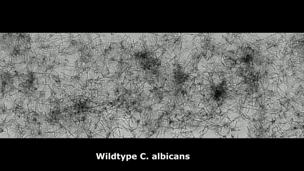 Biofilm videos 1