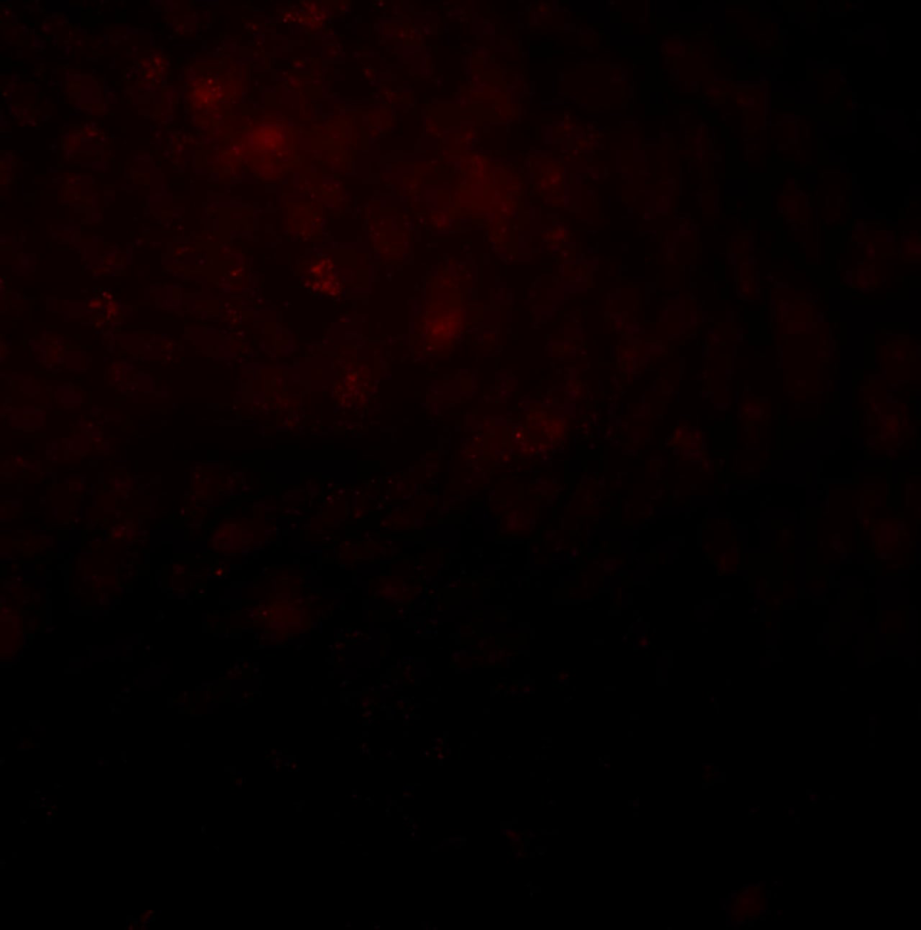 CHO treated with TBH 1