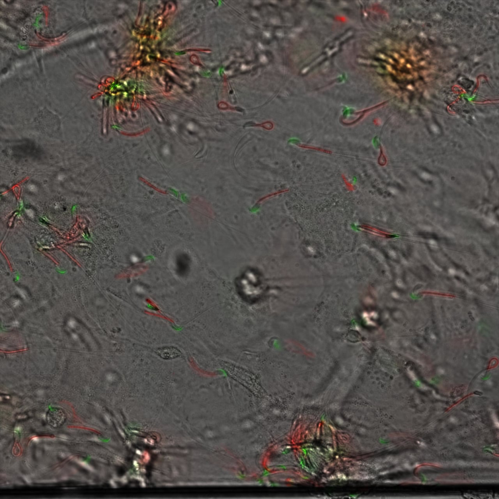 Labeled sperm cells with tdTomato mitochondria and eGFP sperm head interacting with MEF cells 1