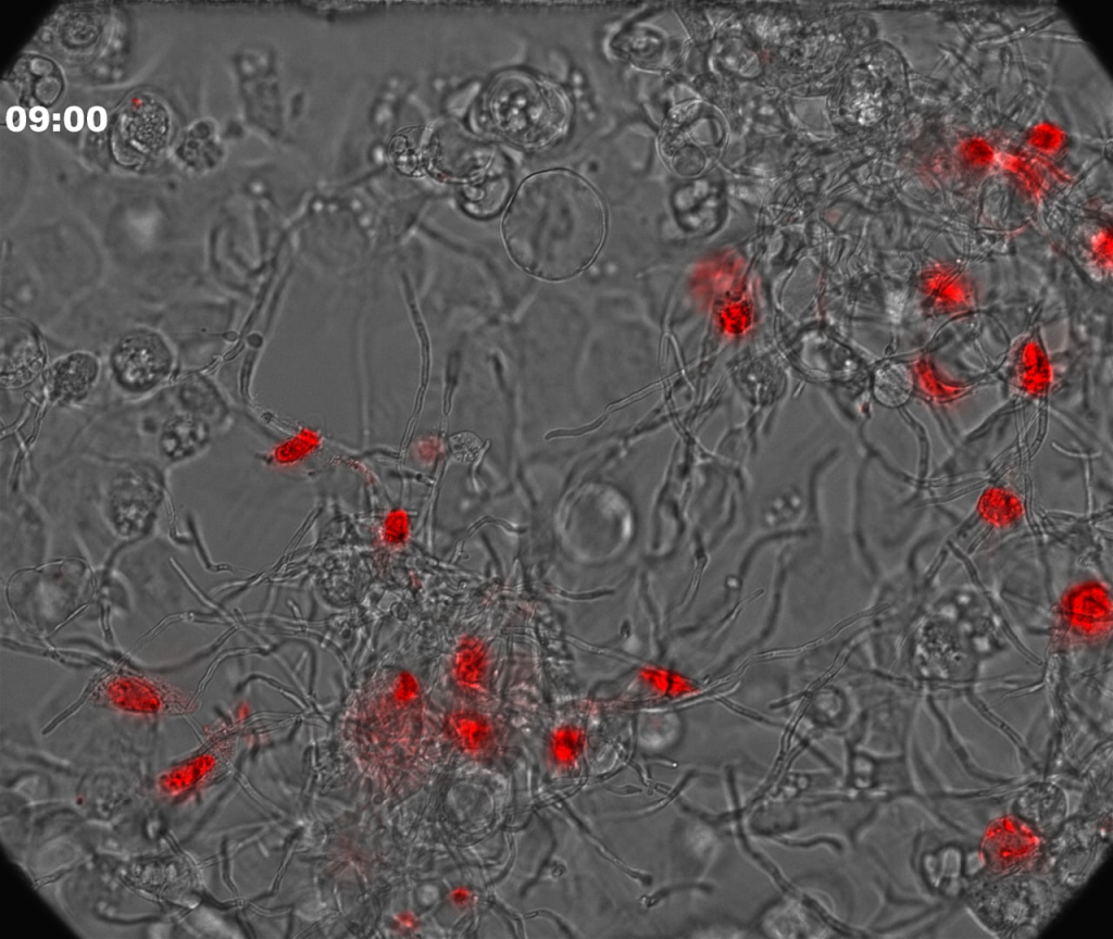 Vaginal epithelial cells exposed to C albicans stained with PI 1