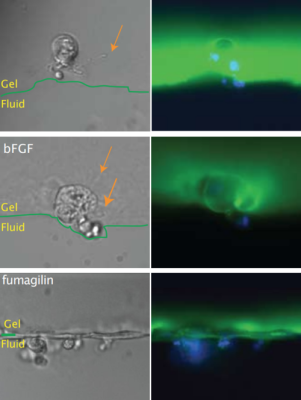 angiogenesis