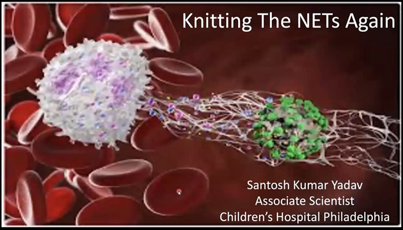 Santosh Yadav webinar thumbnail