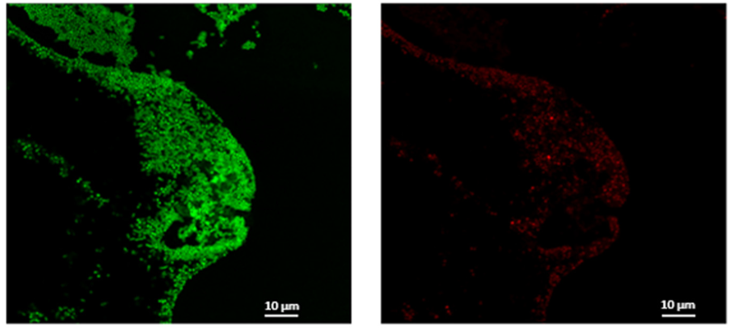 S. aureus and P. aeruginosa stained with Syto9 and PI