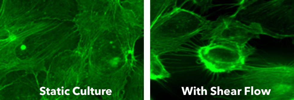 Cancer interaction with endothelial cells